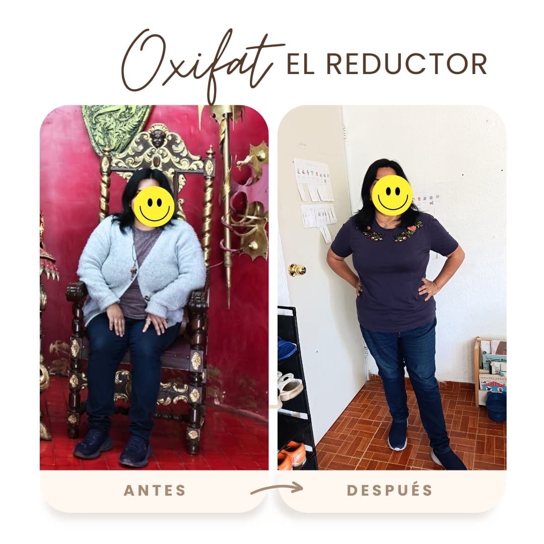 Evolución de tallas Oxifat